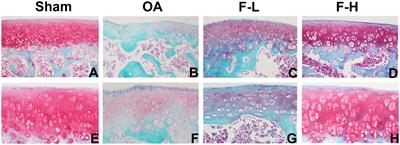 Fengshi Gutong Capsule Attenuates Osteoarthritis by Inhibiting MAPK, NF-κB, AP-1, and Akt Pathways